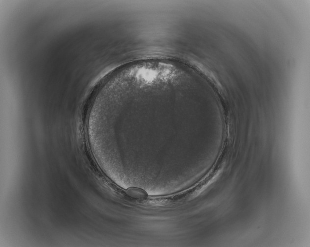 X0000111651453200908281039