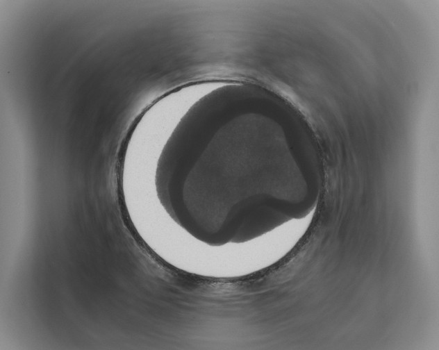 X0000111651463200908281039
