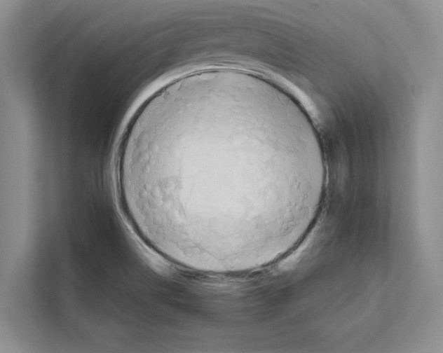 X0000111651514200908281039