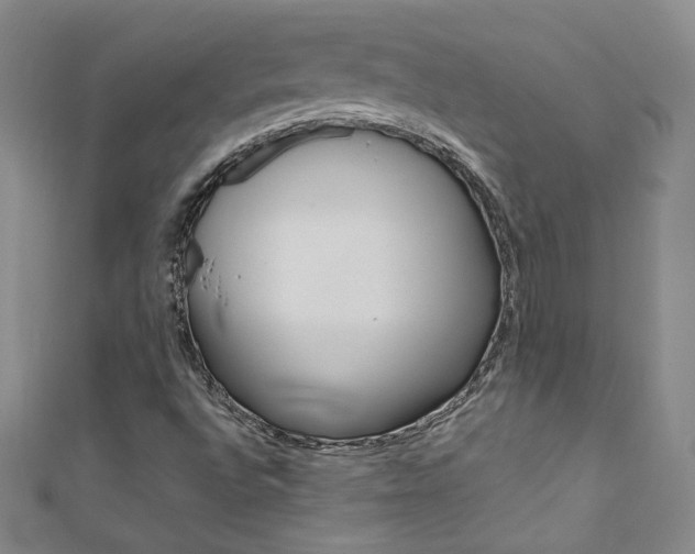 X0000111661496200907171109
