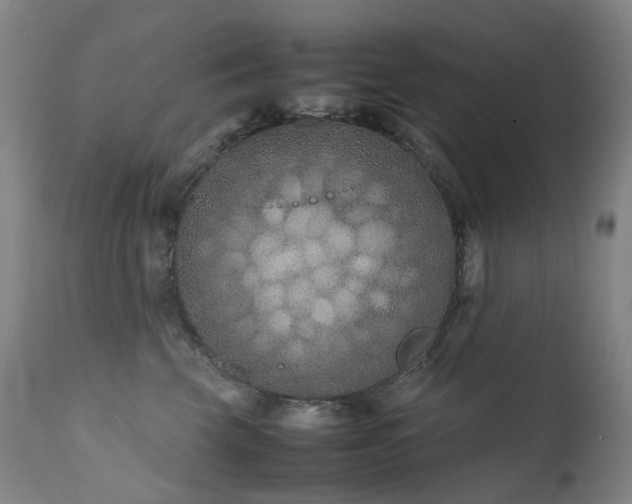 X0000111660569200907171612