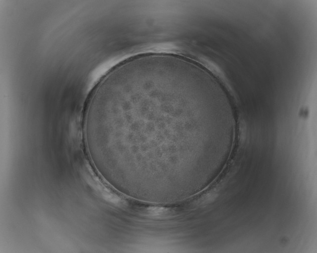 X0000111661176200907171602