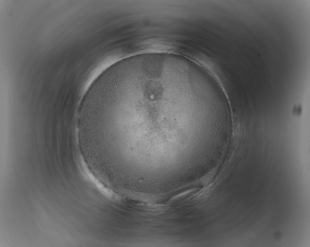 X0000111661235200907171602