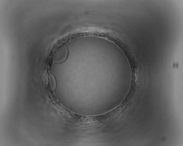X0000111661493200907171556