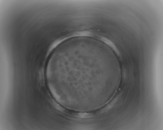 X0000111661176200907241145