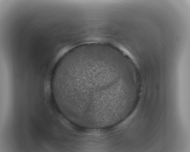 X0000111661259200907241144