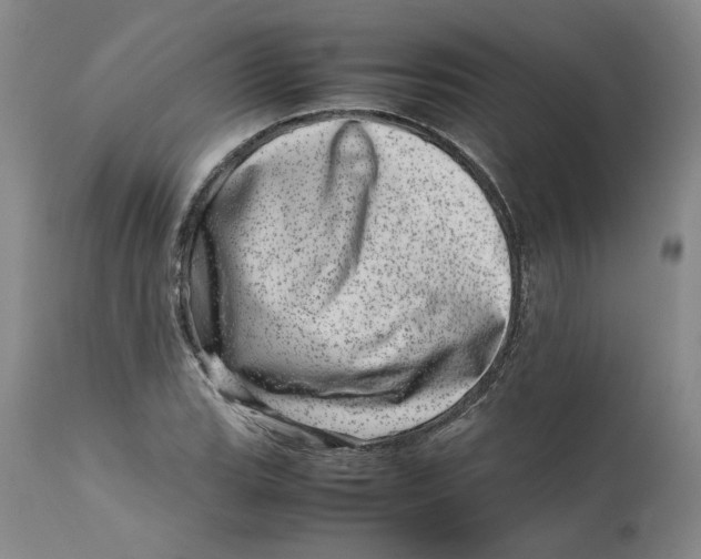 X0000111661119200908071426