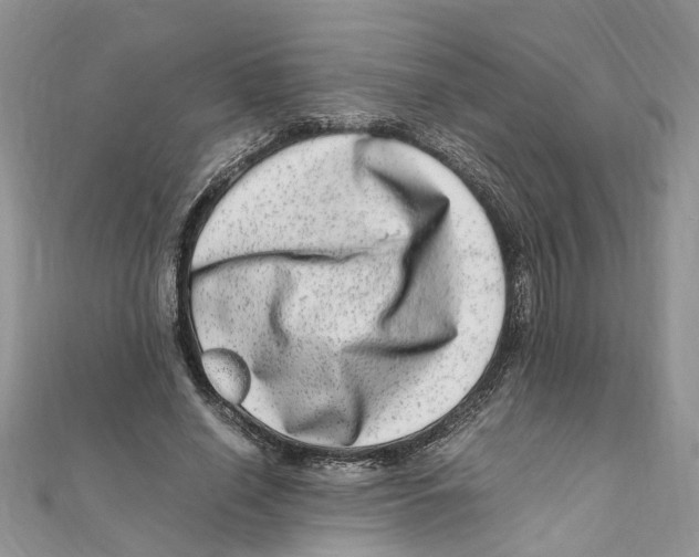 X0000111660638200908141314