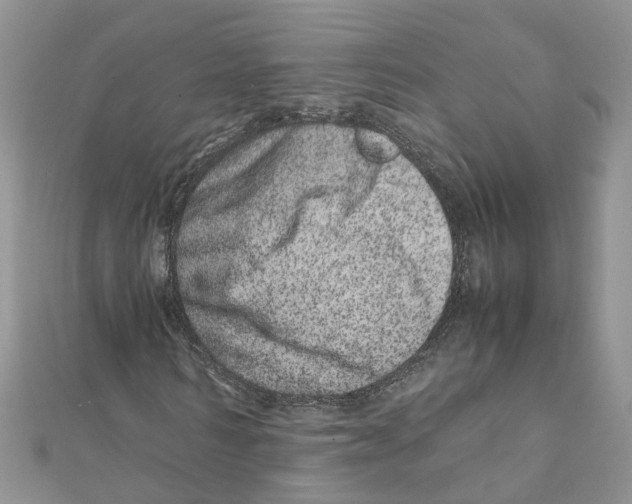 X0000111660962200908141310