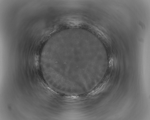 X0000111661156200908141307