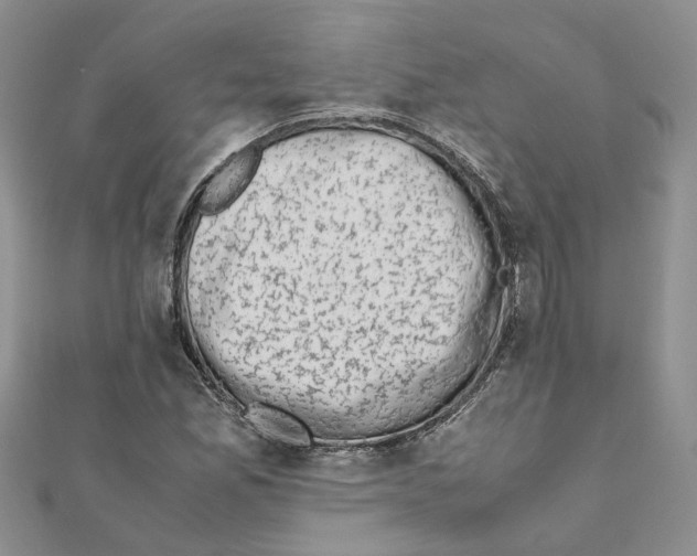 X0000111661165200908141307