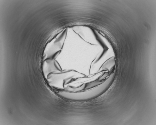 X0000111661185200908141307