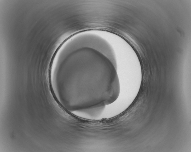 X0000111661291200908141305