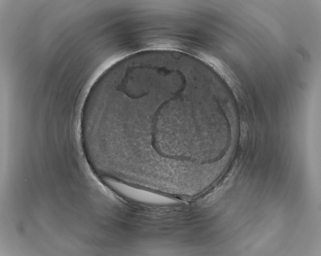 X0000111661331200908141305