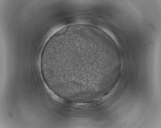 X0000111661439200908141304