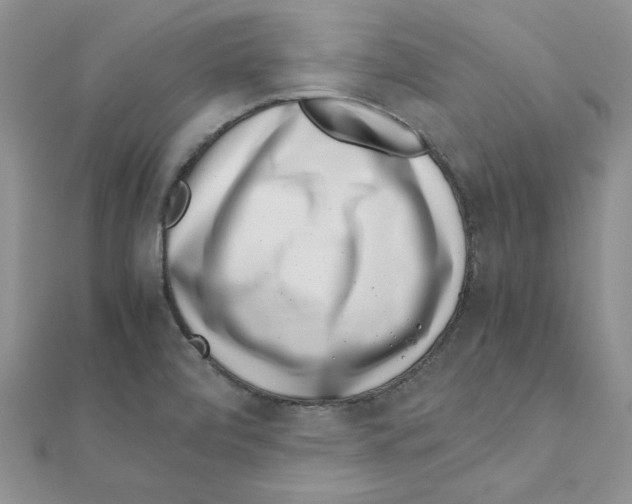 X0000111661472200908141303