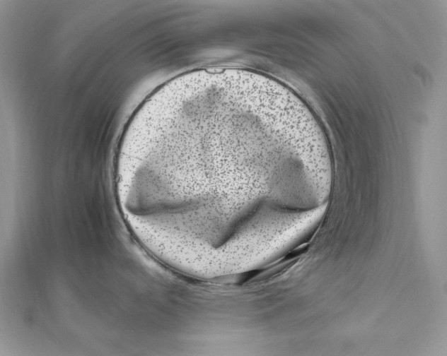 X0000111661488200908141303