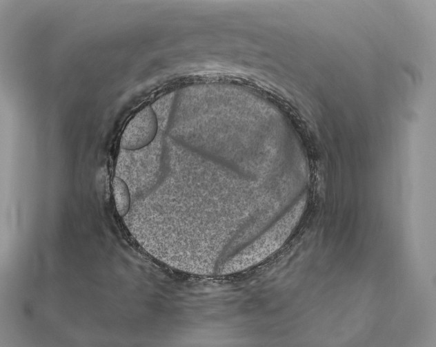 X0000111661493200908141302