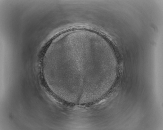 X0000111661496200908141302