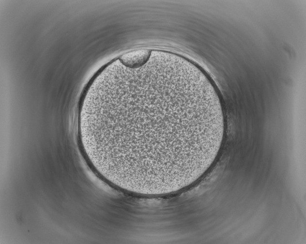 X0000111661515200908141302