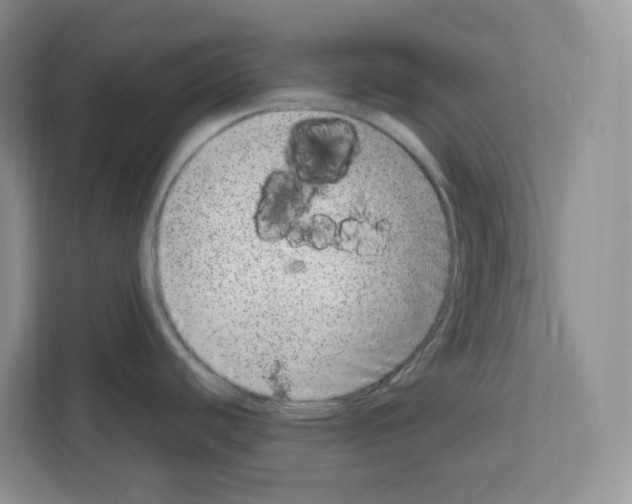 X0000111661440200908281100