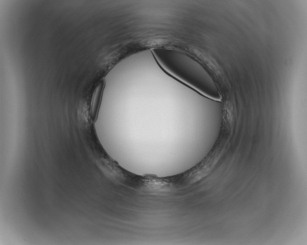 X0000111670380200907171449