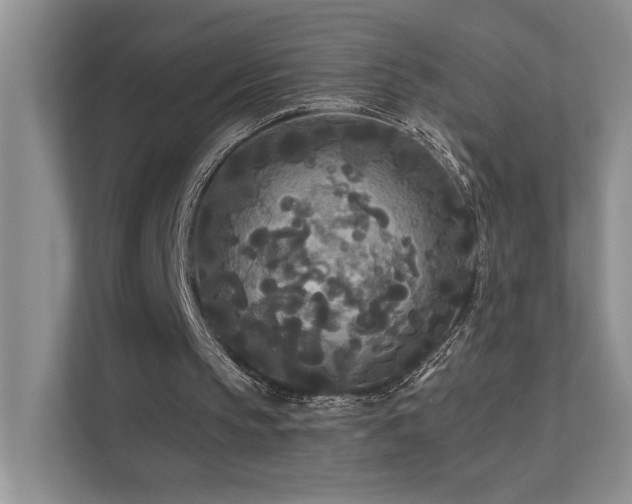 X0000111670145200907171620