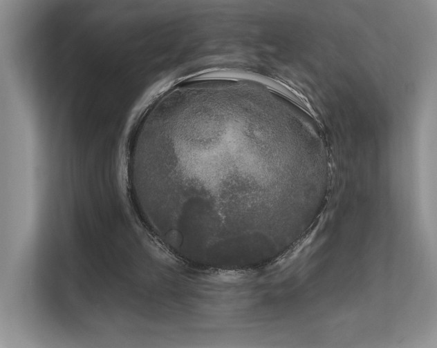 X0000111670149200907171620