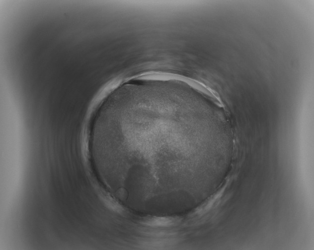 X0000111670149200907241219