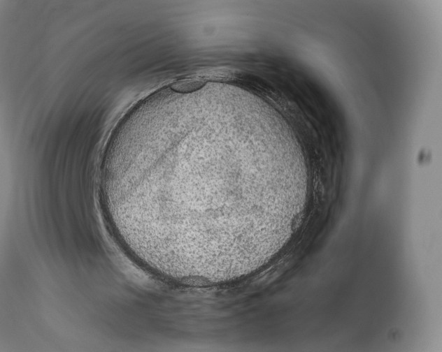 X0000111670049200908071507