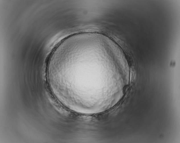 X0000111670339200908071502