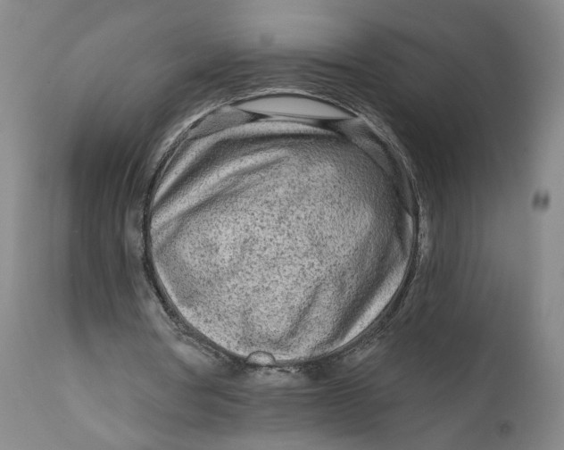 X0000111670386200908071502