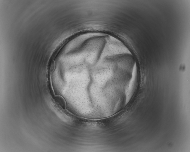 X0000111670439200908071501