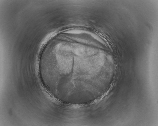 X0000111670149200908141436