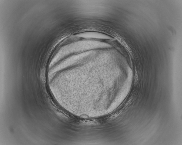 X0000111670386200908141433