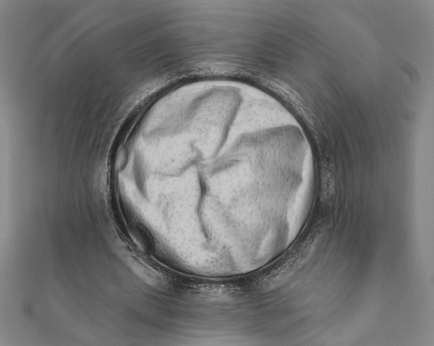 X0000111670439200908141432