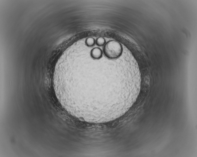 X0000111670869200908141426