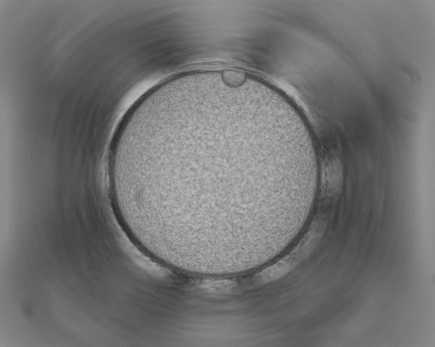 X0000111671466200908141418