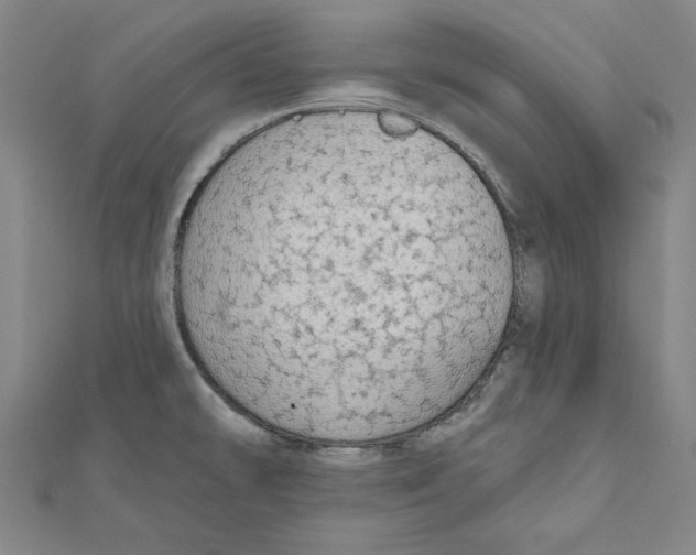 X0000111671478200908141418