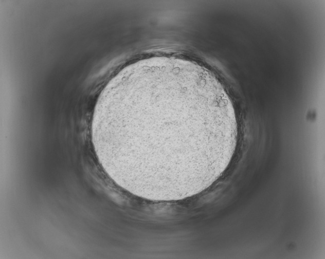 X0000111671399200908281100