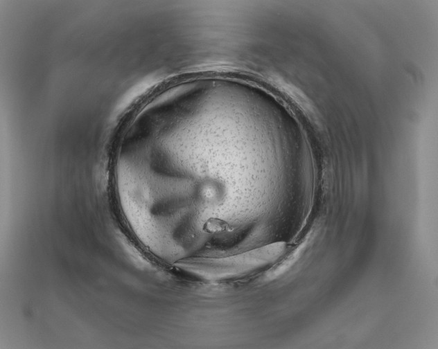 X0000111681406200908071415