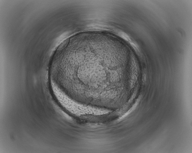 X0000111681459200908071415