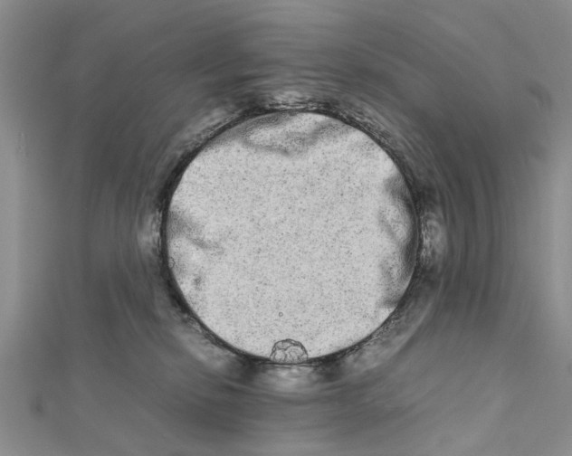 X0000111680278200908141456