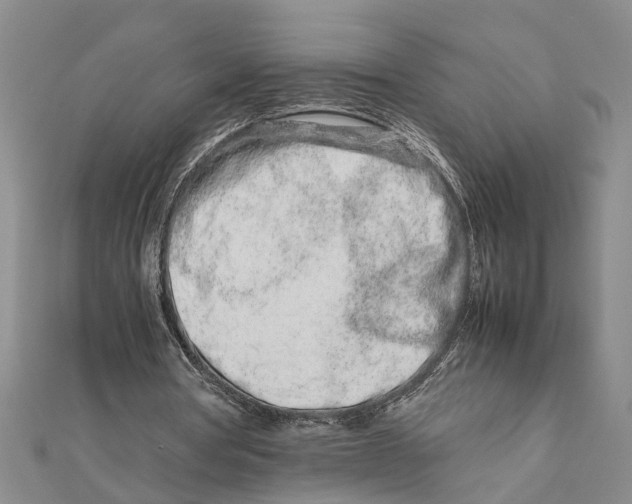 X0000111680386200908141454