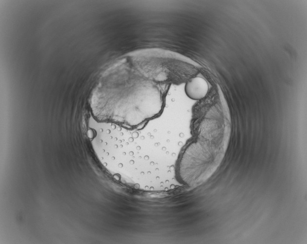 X0000111680573200908141452