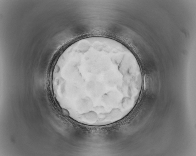 X0000111680579200908141452