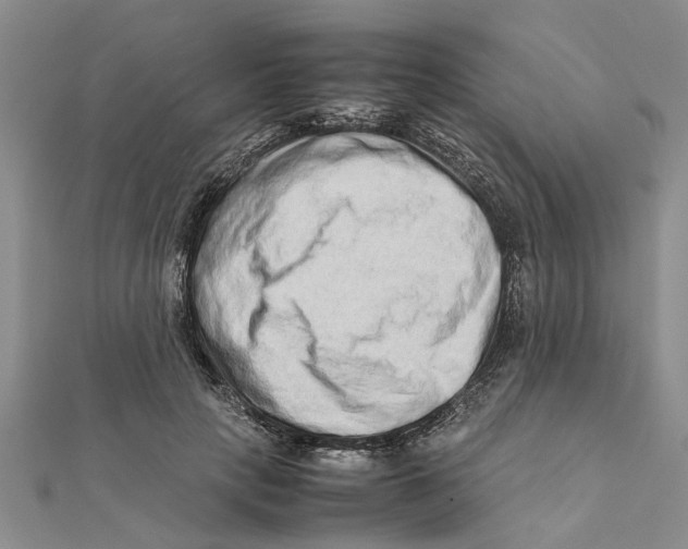 X0000111680649200908141451