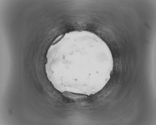 X0000111681057200908141445