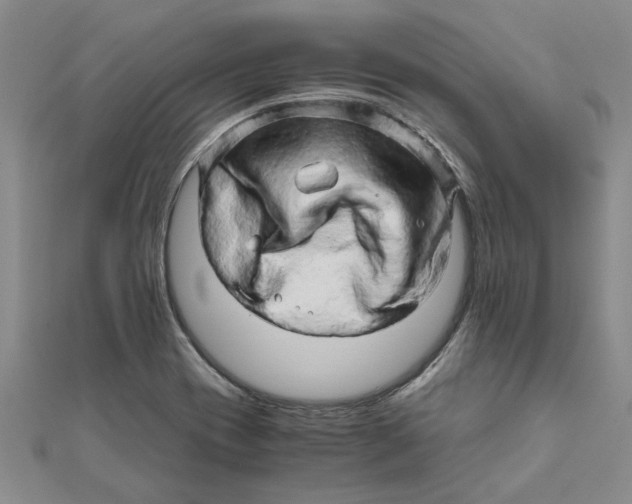 X0000111681417200908141440