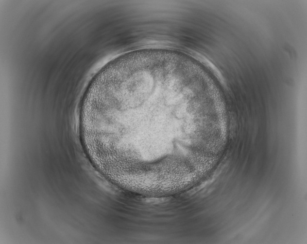 X0000111681419200908141440